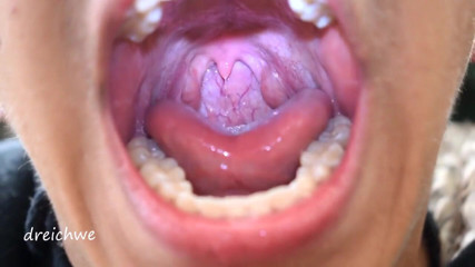 Dreichwe: Uvula fetish mouth