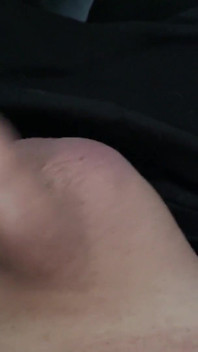 Small Forskin Penis