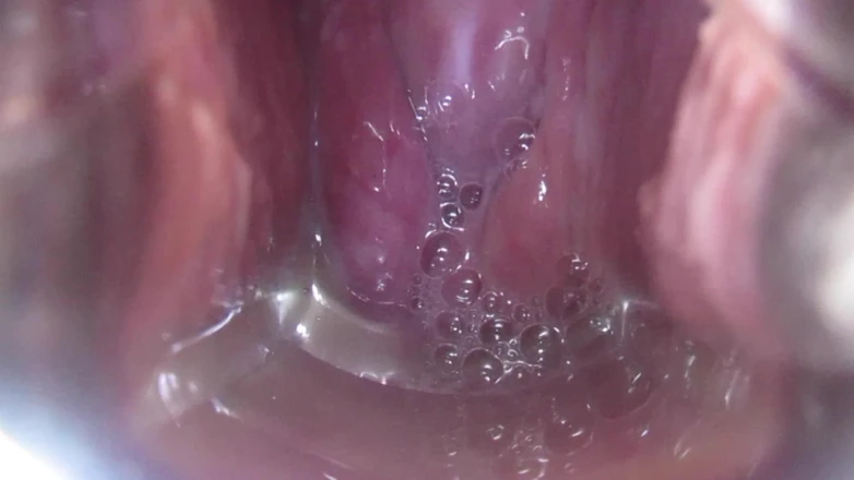 VeeVee Vixen: Cum Cervix Insemination
