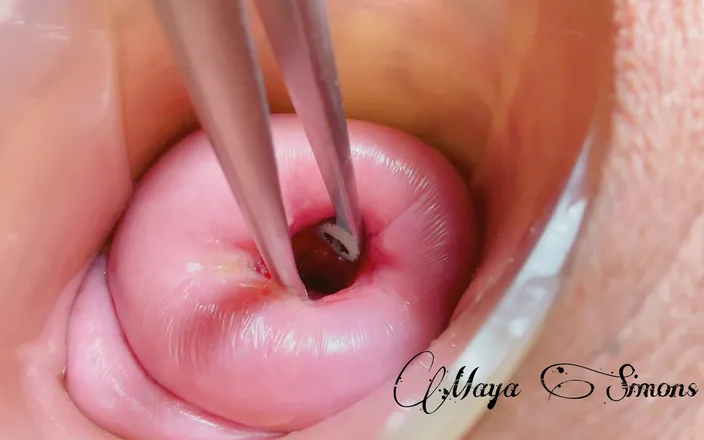 Maya Simons: Cervix Without Extreme Dilation