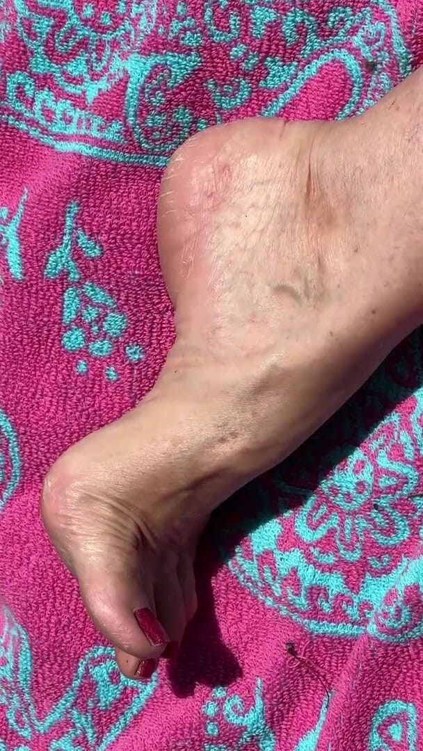 Aunt Ann: Žádost fanoušků babička nahá na slunci ukazuje špinavá drsná chodidla &amp; Prsty...