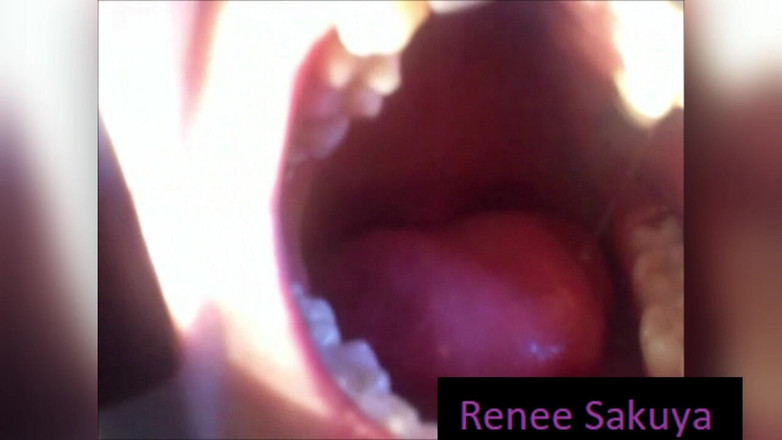 Renee Sakuya: Feticcio dei denti in bocca