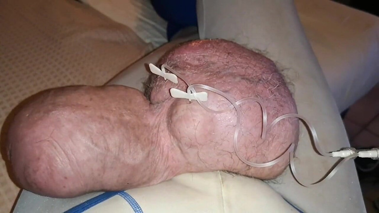 Monster_Meat_: Dubbele vullingen van glucose van 2 liter