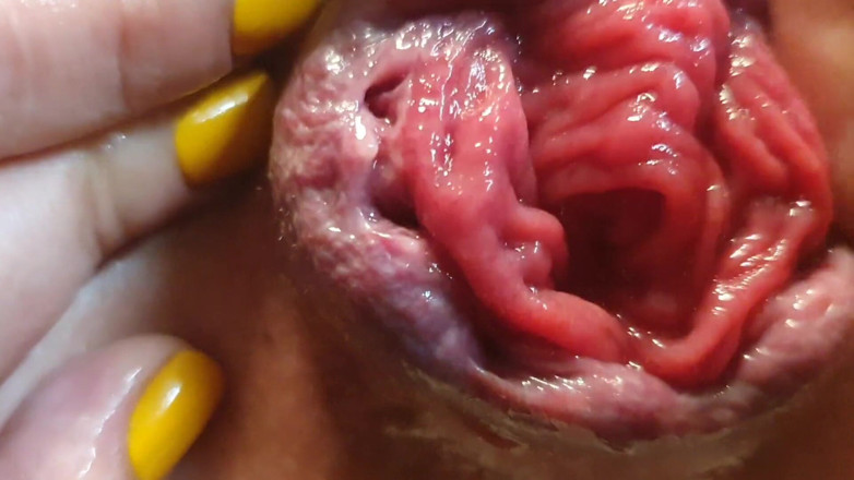 Dirty Molly: Can't Stop Squirting After Vacuum Pump Anal Prolapse with Rose