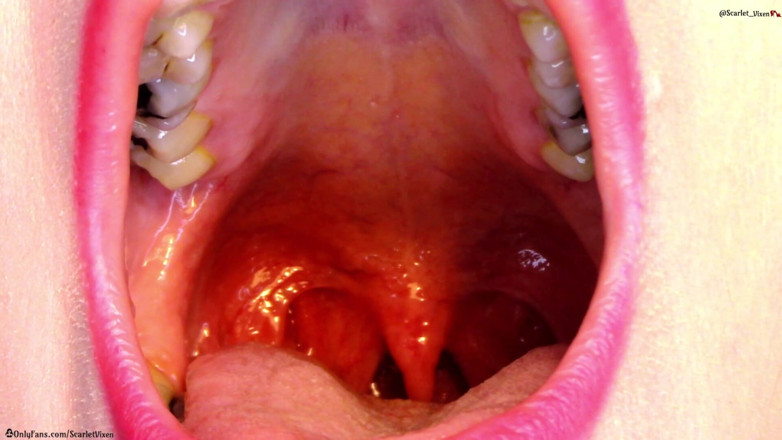 Scarlet Vixen: Hals, uvula und mund zeigen