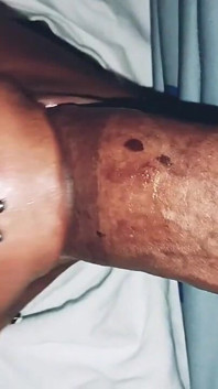Mencuci batang selamba dilumpuhkan bahagian 1