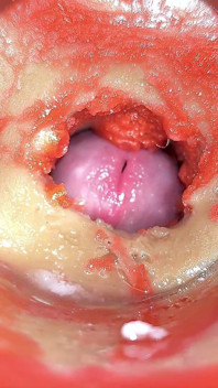 Camera in Anal Cervix POV, Tiny Cucked by Giant ‘couple’, Cum in Anal and Creampie - Asmr