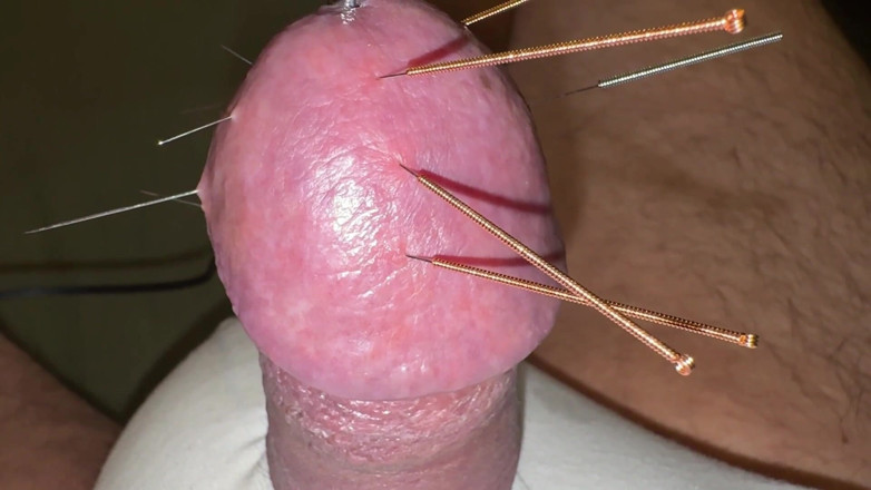 Qualzucht: Acupuncture - Orgasm!