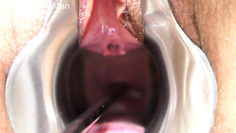 TripleXTransMan: 子宮頸部に挿入!