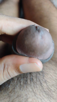 My Penis