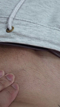 The Hair on My Penis - Led Hair Removal
