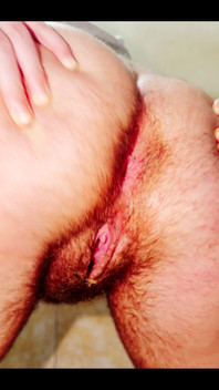 My Breasts Grew so Much These Past Few Months That They're Covered in Stretch Marks
