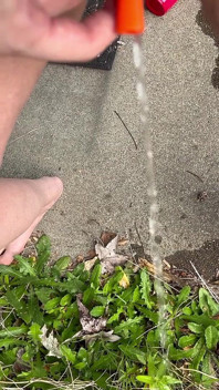 Peeing Through Catheter Outside