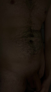 My Hairy Body