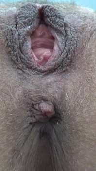 Molto Primo Piano Della Vagina Pelosa Bagnata Con