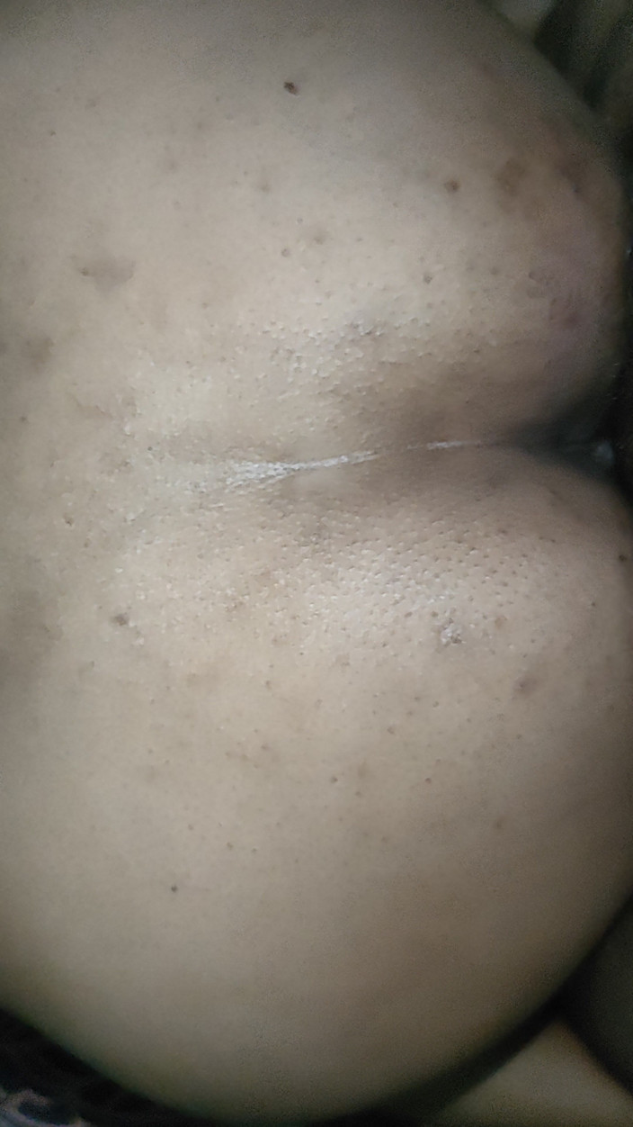 Lovelyindian: สาวอินเดีย Desi โดนเย็ดในท่าหมา