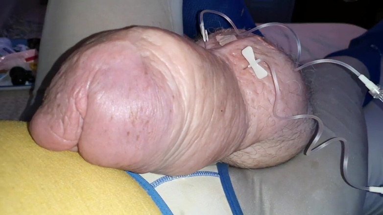 Monster_Meat_: Cockzilla S kembali selepas menambah glukosa 2liter
