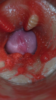 Kamera in Tiefe Muschi Fängt Sehr Riesige Ejakulation Von Sperma Asmr Ein