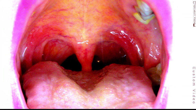 Scarlet Vixen: 性感的Scarlet说 ahhhh - uvula showoff