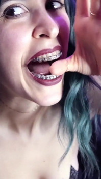 Biting My Fingers - Bite, Mouth, Teeth, Braces, Fetish Ita