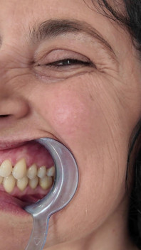 Dental Hygienist Routine Mouth Fetish Closeups in Topless