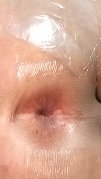 Opening My Ass