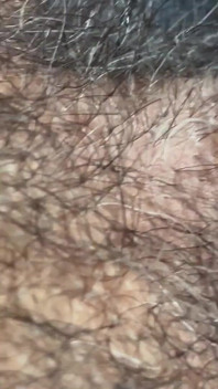 Detailní záběr na penis s one vein