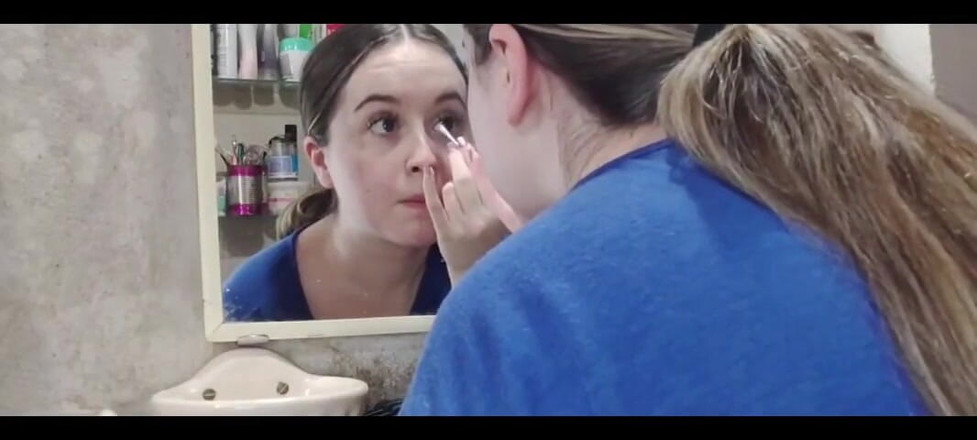 RavenHearth666VIP: 털이 없는 머리