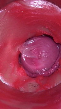 กล้องในหี: ทรงพลังแตกในหี! Asmr ภายในที่ดีที่สุด