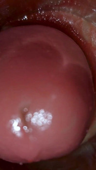 Camera Inside Deep Pussy Captures Huge Ejaculation of Sperm Asmr