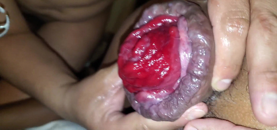 JireHorny: Prolapso Gigante