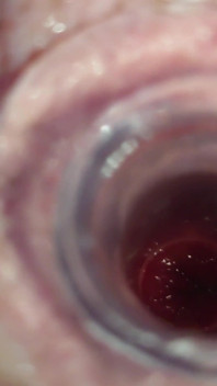 The Little Test with the Anal Tunnel