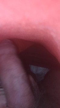 My Dick
