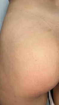 Eine Zusammenstellung von Pinkeln in verschiedenen Hotels! Höschen mit Polsterung! POV!
