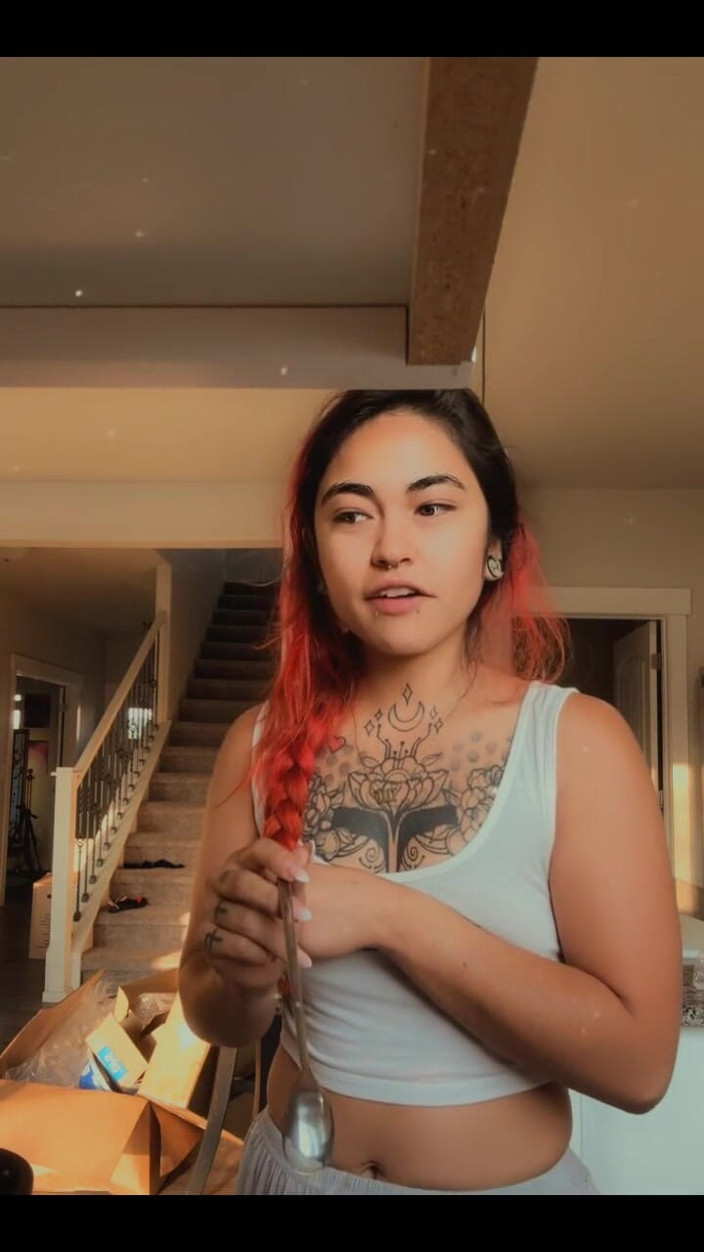 lilRavenFox: Omg a Long Lil Update My Foot Is Healing!