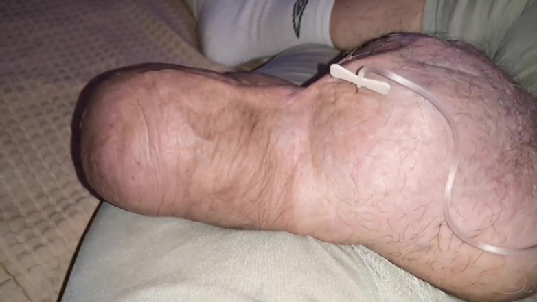 Monster_Meat_: Glukosa dua liter di dalam silikon 1380ccku