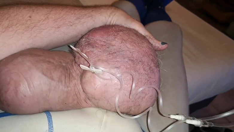 Monster_Meat_: Podwójne napełnianie glukozy 2liters