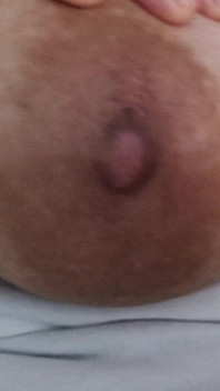 Nudes
