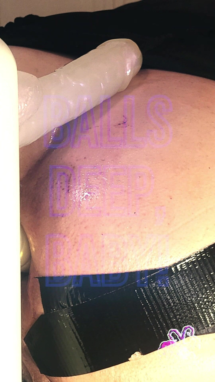 kandiKane: Kandi Kane si protahuje zadek 2 dilda - analmaxxing s Kandi