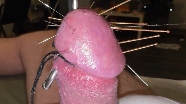 Qualzucht: Acupuncture - Orgasm!