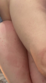 Op legged Vetran met behulp van Kaliyatgirl
