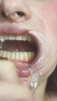 Pulizia dei denti con spazzolino da denti, irrigatore, gancio dentale