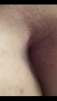 My hole today