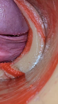 Inseminación Femenina - Cámara Interna Captura Una Enorme Eyaculación Masculina Profunda