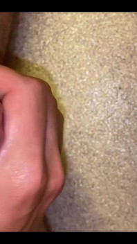 CBT Extreme Urethra Penis Insertion Cum