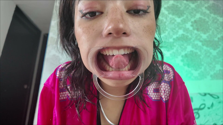 KiyuSweetCrazy: Cheeks Pulled Apart Teeth Exposed