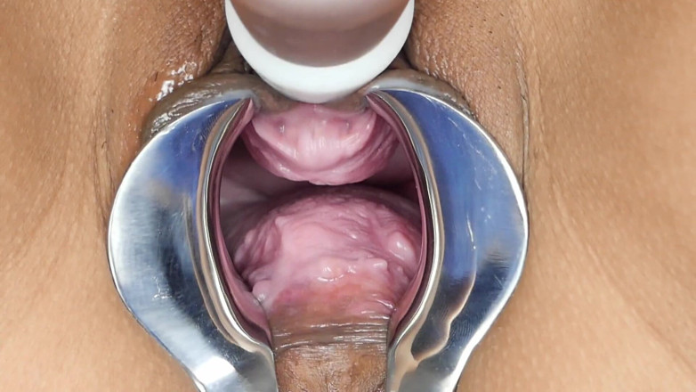 SexyThai1987: Speculum - aruncă o privire adânc în mine