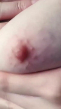Otra parte de Boette