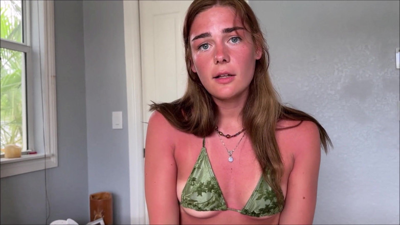 Alex Adams: Little Stepsister's Sunburn Accident - Arabella Rose - Family Therapy