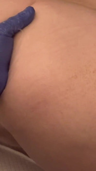 Esguichando enquanto punho anal